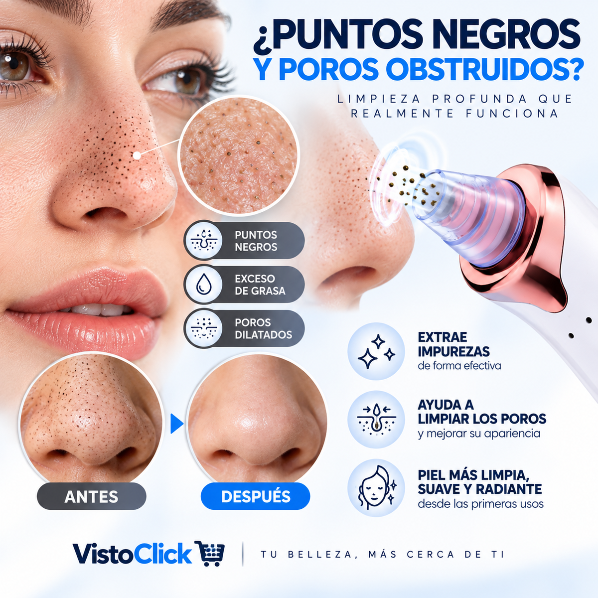 Limpiador de Puntos Negros